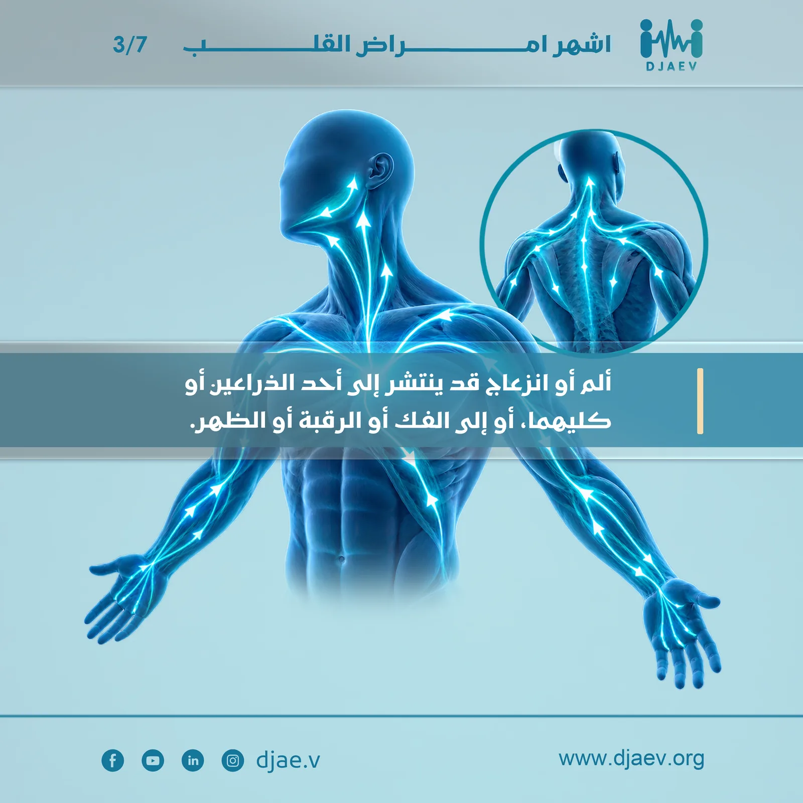 شريحة 3 من 7